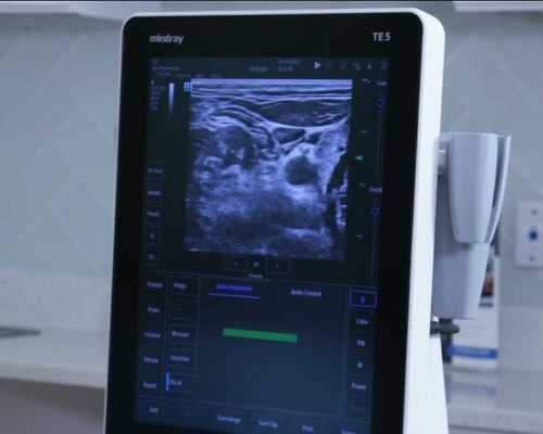 The ultrasound monitor in the Reboot Vitality treatment room showing the neck view used to guide a stellate ganglion block, from the WFLA Bloom Tampa Bay segment
